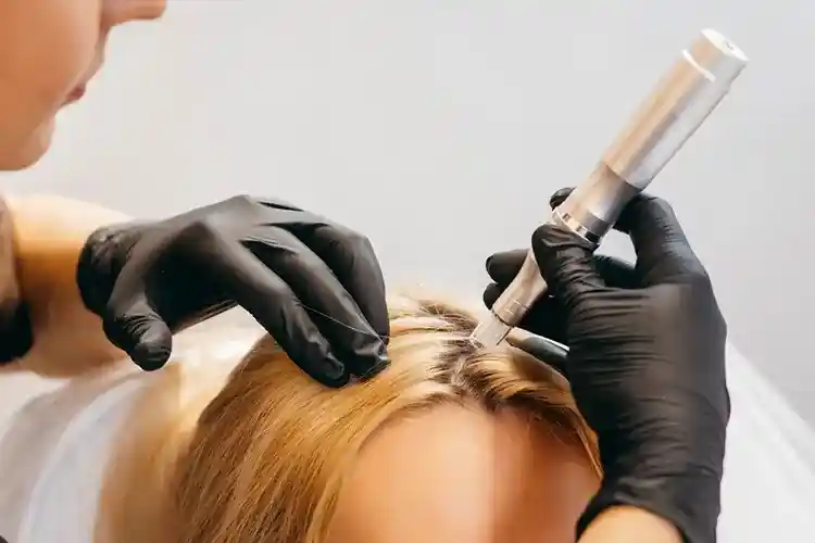 PRP Treatment for Hair in lucknow provided by The Velvet Skin Centre, Dermatologist in Lucknow, Skin Specialist in Lucknow