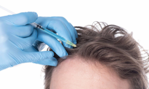 prp treatment in lucknow