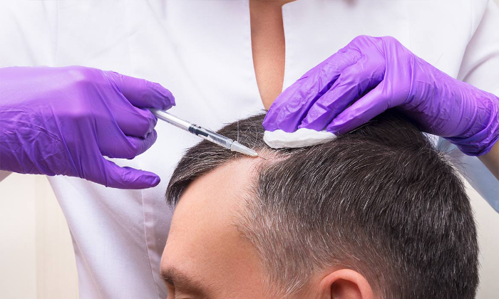 (PRP) treatment in Lucknow