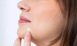 best skin doctor in lucknow