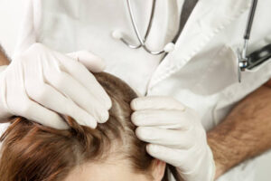 hair fall treatment in lucknow 