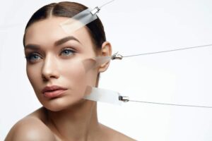threadlift treatment in lucknow