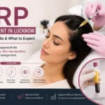 PRP treatment for hair & skin