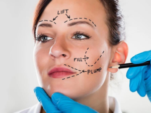 facelift treatment in lucknow