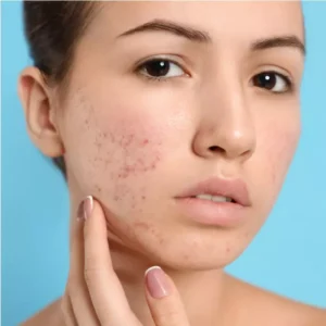 skin specialist in lucknow