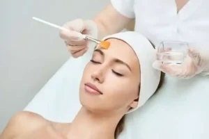 chemical peel in lucknow - best dermatologist in lucknow