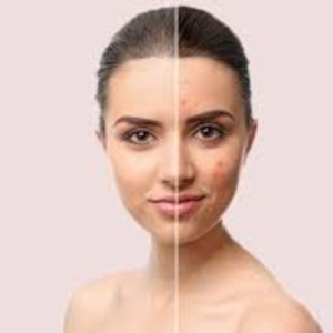 Skin Care Treatment in Lucknow