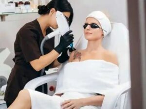 Laser Tattoo Removal in Lucknow