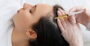 prp for hair in lucknow