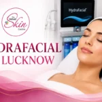Hydra Facial in Lucknow