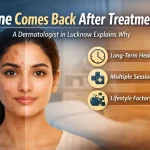 Acne treatment and healing explained