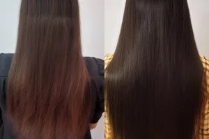 Is PRP Safe for Hair?