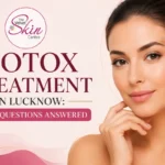 Botox Treatment Questions Answered